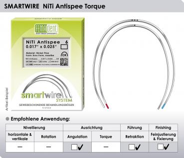 Preview: SMARTWIRE NiTi Antispee Torque